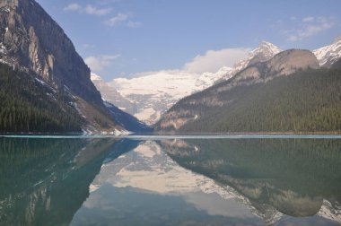 Banff Ulusal Parkı 'nda Louise Gölü. Kanada.