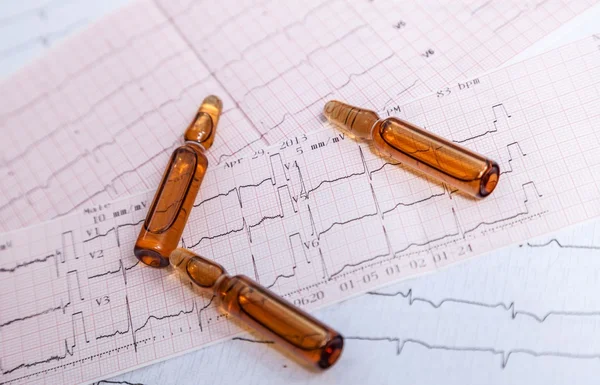 EKG control de la frecuencia cardíaca — Foto de Stock