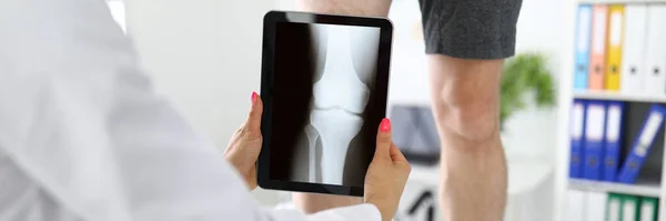 Traumatologist is holding tablet near patients sore leg in the clinic closeup.