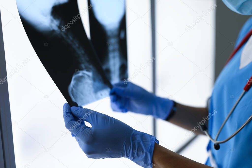 Doctor with gloves holds two x-rays closeup