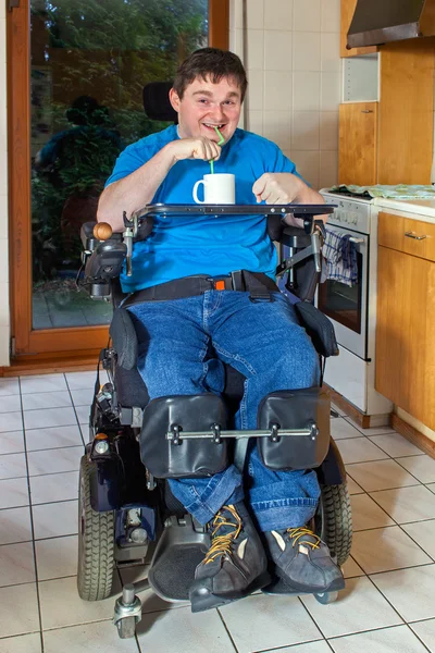 Man with infantile cerebral palsy — Stock Photo, Image