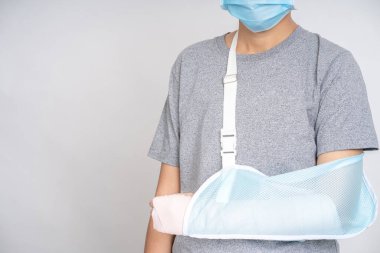 Asyalıların eli, kırık kolu desteklemek için kol askısı kullanır..