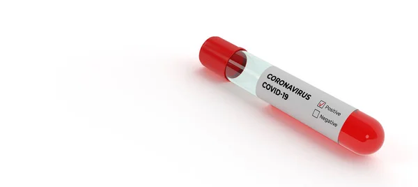 Covid Test Corona Virus Infectie Positief Testresultaat Door Gebruik Maken — Stockfoto