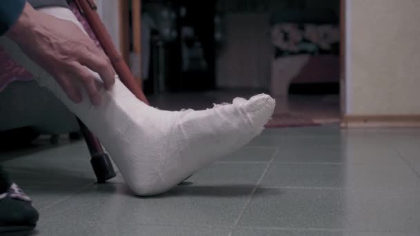 Detailní Záběr Zlomené Nohy Zabalené Omítce Zotavení Zranění Omezený Pohyb — Stock video