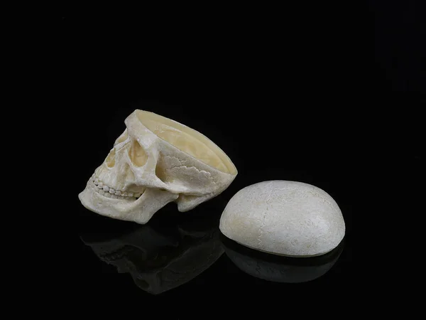 Human skull without the top of the head, which lies nearby on a black background, a symbol of the problem, disease — Stockfoto