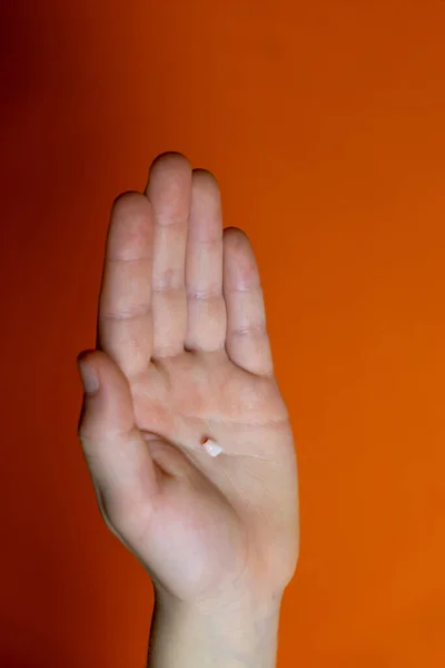 Gevallen Melktand Hand Van Een Klein Kind — Stockfoto