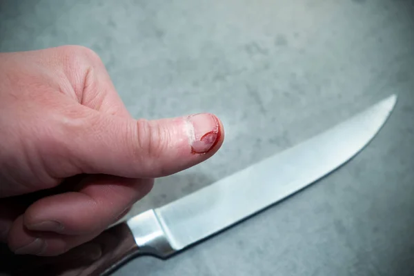 a man cut himself with a knife, cut his thumb with a kitchen knife, injury at home.