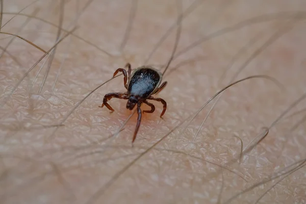 Milben Arachnid Parasit Insekt Auf Der Haut Makro Übertragenden Enzephalitis — Stockfoto