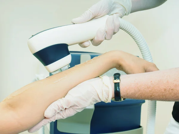 Laser-Haararmentfernung Epilation. Behandlung im Kosmetiksalon. — Stockfoto