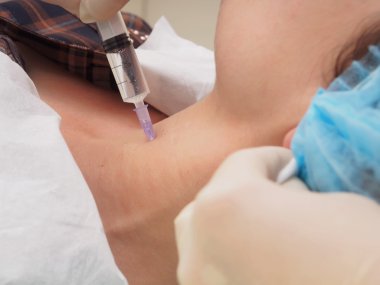 Kozmetik prosedür mesoteraphy. Gençleştirme yeniden canlandırılması, cilt beslenme, kırışıklık azaltma. Doktor yapma microneedle ekleme.