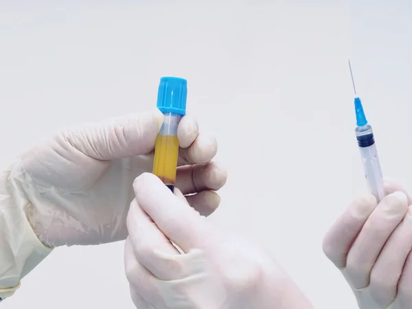 Hands holding separated blood and syringe in test tube at  laboratory — Stock Photo, Image