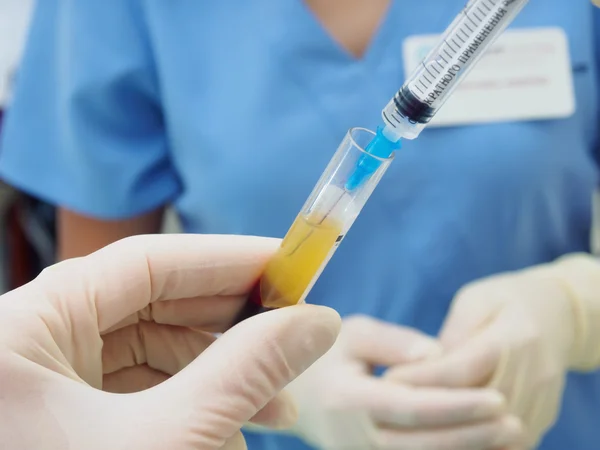 Handen met gescheiden bloed en spuit in de reageerbuis in laboratorium — Stockfoto