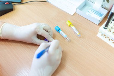 Bulanık bir arka planda laboratuvar kliniğinde test tüplerine yazı yazan bilim adamı..