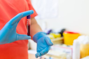 Kadın hemşire, üzerinde COVID-19 olan bir kan örneğiyle test tüpü tutuyor. Hemşire laboratuvar kliniğinde kan testi tüpü tutuyor. Yakın plan..