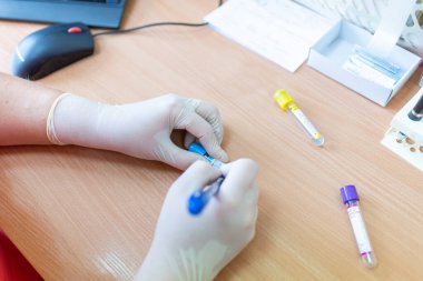 Bulanık bir arka planda laboratuvar kliniğinde test tüplerine yazı yazan bilim adamı..
