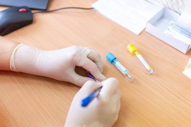 Bulanık bir arka planda laboratuvar kliniğinde test tüplerine yazı yazan bilim adamı..