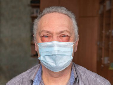 Evde tıbbi maskeli bir adam var. Gözlerinde şişlik var. Covid 19