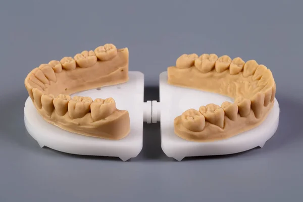 Mold of teeth. Gypsum model plaster of teeth. Plaster cast of teeth from human in preparation for producing a dental crown. Dentistry and orthodontics concept.