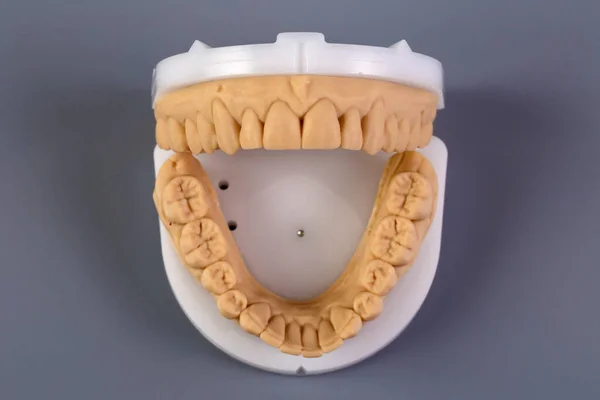Mold of teeth. Gypsum model plaster of teeth. Stomatologic plaster cast, molds of human jaws and teeth on gray background. Dentistry and orthodontics concept.