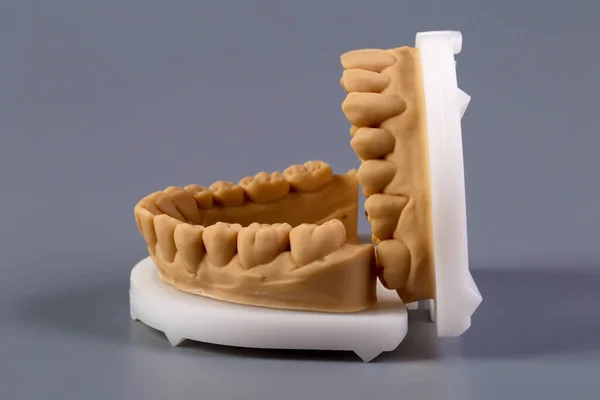 Mold of teeth. Gypsum model plaster of teeth. Stomatologic plaster cast, molds of human jaws and teeth on gray background. Dentistry and orthodontics concept.