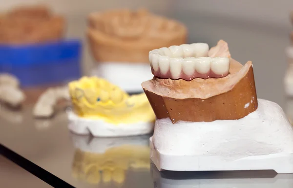 Zirconium Porcelain Tooth plate in Dentist Store — Stock Photo, Image