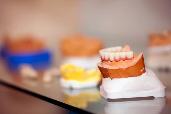 Placa de dentes de porcelana de zircônio na loja de dentista — Fotografia de Stock