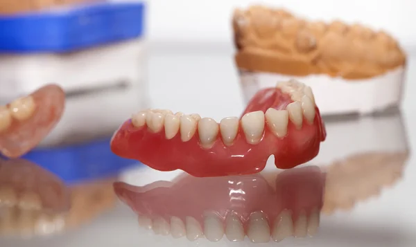 Zirkonium Porzellan Zahnplatte im Zahnarztladen — Stockfoto