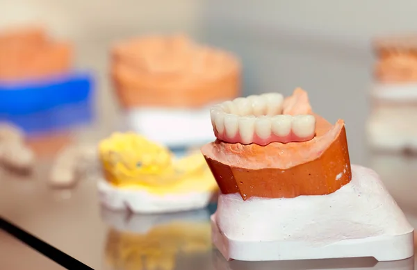 Zirconium Porcelain Tooth plate in Dentist Store — Stock Photo, Image