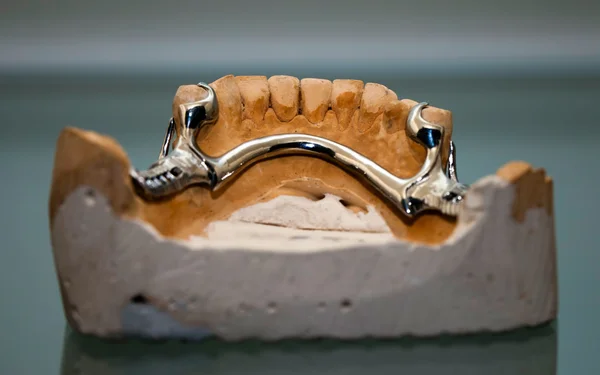 Zirkonium Porzellan Zahnplatte im Zahnarztladen — Stockfoto