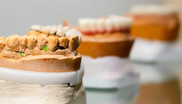 Placa de dientes de porcelana de circonio en la tienda de dentistas — Foto de Stock