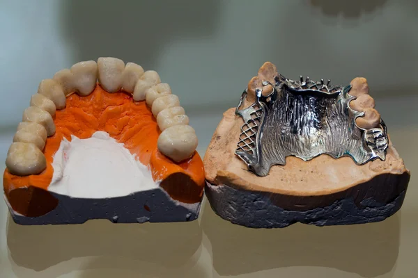 Zirconium Porcelain Tooth plate in Dentist Store — Stock Photo, Image