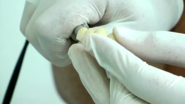 Dar forma ao dente de zircônio no laboratório — Vídeo de Stock