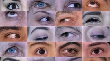 Gözleri farklı türde taşıma