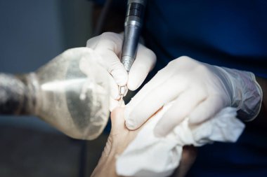 Yetişkin bir adamın ayaklarına nasırlı lateks eldiven takan bir ayak hastalıkları uzmanının yakın çekimi..