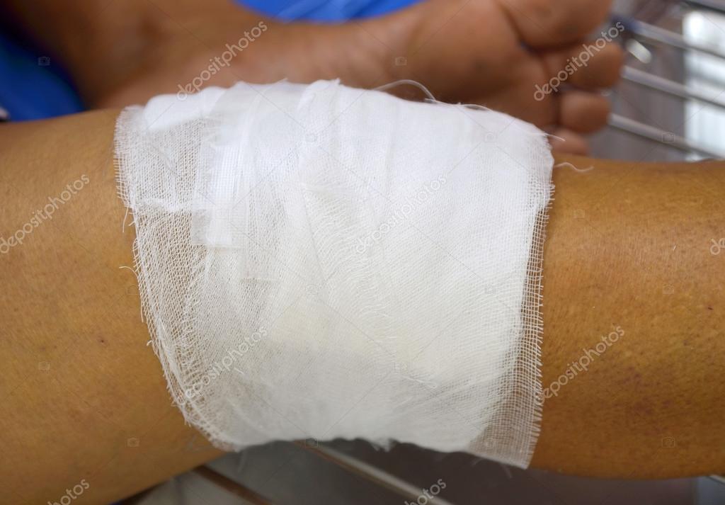 Knee gauze Stock Photo by 65519471