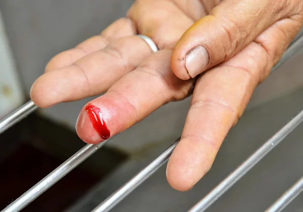 Sangrado del dedo — Foto de Stock