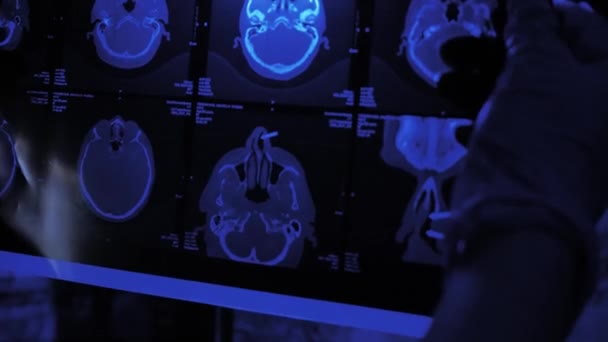 MRT av hjärnan hos en äldre man — Stockvideo