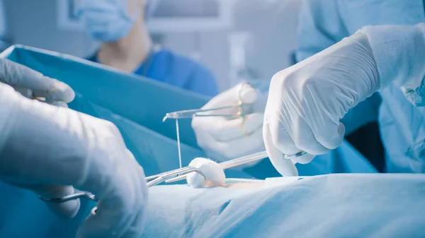 Nahaufnahme der Nahtwunde des professionellen Chirurgen nach erfolgreicher Operation. Im Hintergrund moderner Krankenhaus-Operationssaal. — Stockfoto