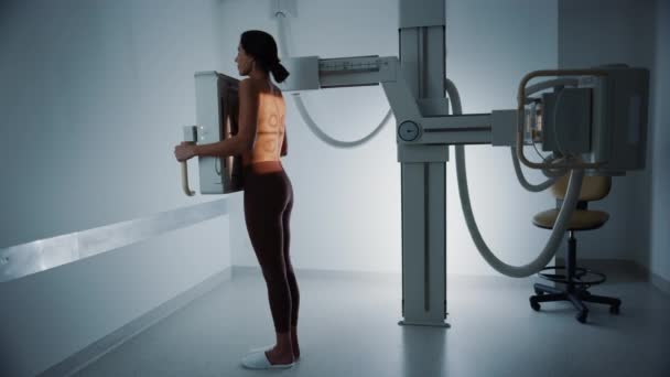 Женщина из больницы получает рентгеновское сканирование со спины — стоковое видео