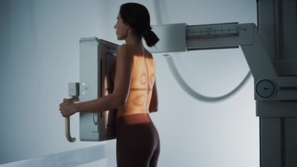 Женщина из больницы получает рентгеновское сканирование со спины — стоковое видео