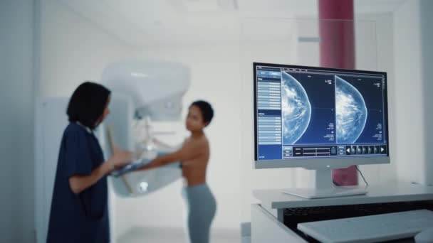 Computer scherm toont mammogram scan — Stockvideo