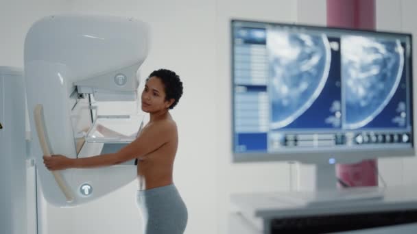 Сканування мамографії пацієнта на екрані комп'ютера — стокове відео