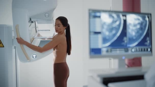 Сканирование женской маммографии на экране компьютера — стоковое видео