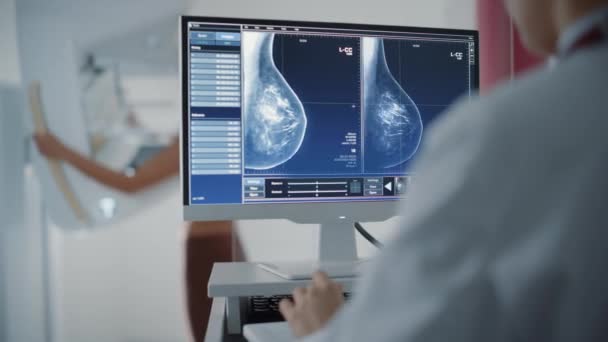 Kvinnlig patient Mammografi Skanna på datorskärmen — Stockvideo