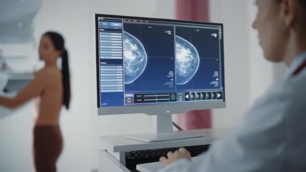 Mammografia femminile paziente Scansione sullo schermo del computer — Video Stock