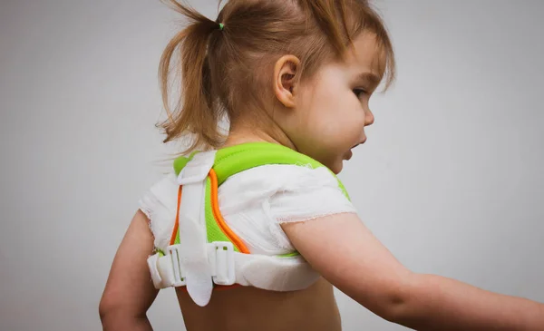 Niña con la clavícula rota o con mala postura en el anillo reclinador del corsé ortopédico Delbe sobre fondo gris azul. Tratamiento de lesiones de columna vertebral y clavícula en niños pequeños y niños —  Fotos de Stock