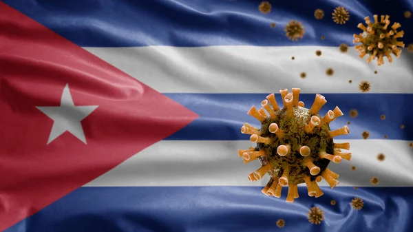 Kubańska Flaga Wymachująca Epidemią Koronawirusu Infekującego Układ Oddechowy Jako Niebezpieczną — Zdjęcie stockowe