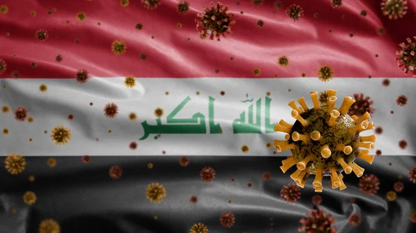 Flu Coronavirus Flotando Sobre Bandera Iraquí Patógeno Que Ataca Tracto — Foto de Stock
