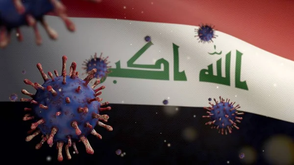Schwebt Das Grippe Coronavirus Über Der Irakischen Flagge Ein Erreger — Stockfoto
