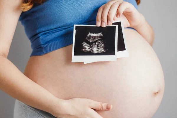 Embarazada Vientre Mujer Gris Estudio Fondo Celebración Tarjeta Las Manos — Foto de Stock